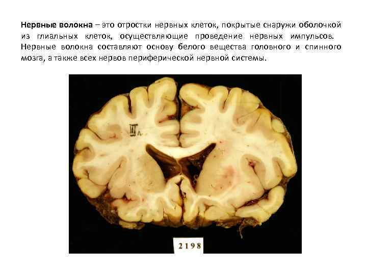 Нервные волокна – это отростки нервных клеток, покрытые снаружи оболочкой из глиальных клеток, осуществляющие