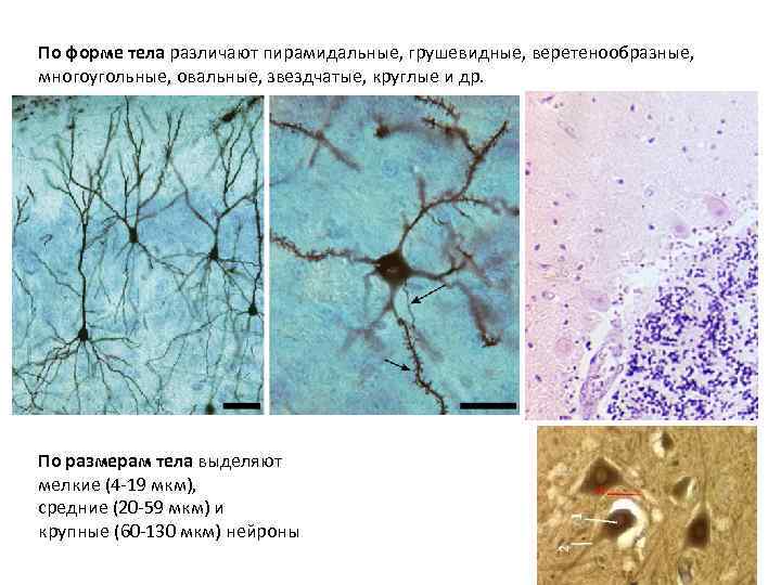 По форме тела различают пирамидальные, грушевидные, веретенообразные, многоугольные, овальные, звездчатые, круглые и др. По