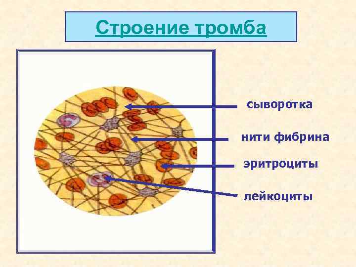 Строение тромба сыворотка нити фибрина эритроциты лейкоциты 