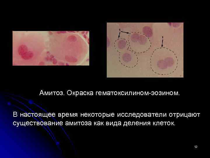 Амитоз. Окраска гематоксилином-эозином. В настоящее время некоторые исследователи отрицают существование амитоза как вида деления
