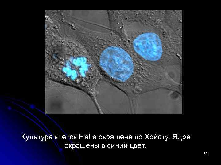 Культура клеток He. La окрашена по Хойсту. Ядра окрашены в синий цвет. 63 