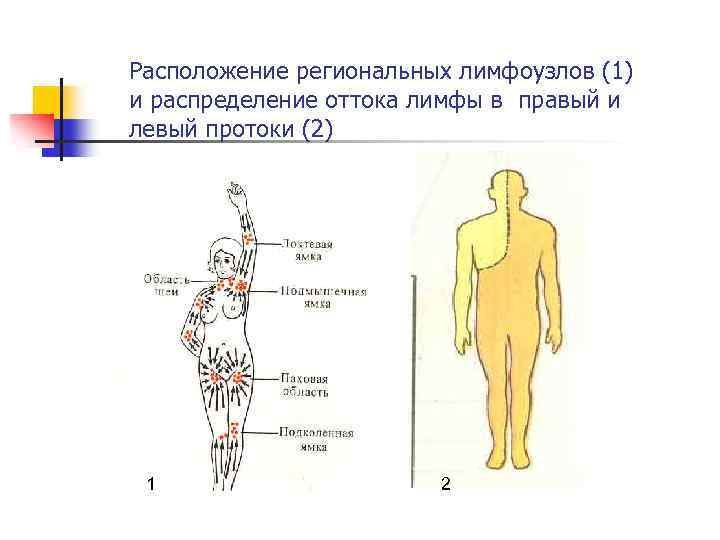 Расположение региональных лимфоузлов (1) и распределение оттока лимфы в правый и левый протоки (2)