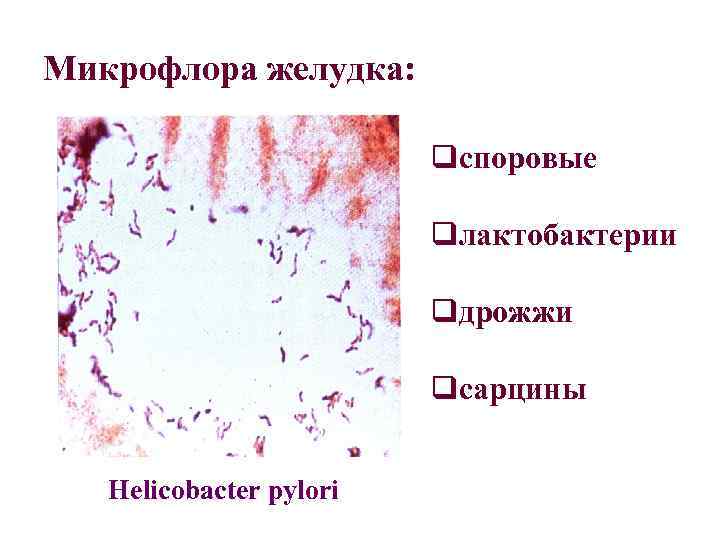 Микрофлора желудка: qспоровые qлактобактерии qдрожжи qcарцины Helicobacter pylori 