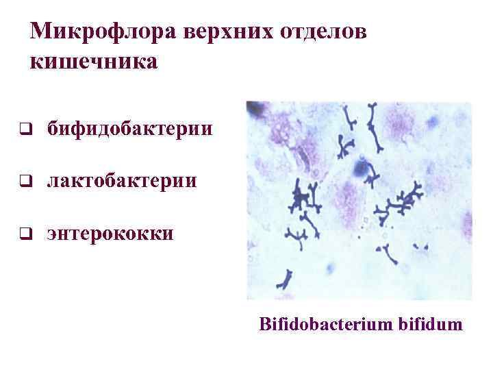 Микрофлора верхних отделов кишечника q бифидобактерии q лактобактерии q энтерококки Bifidobacterium bifidum 