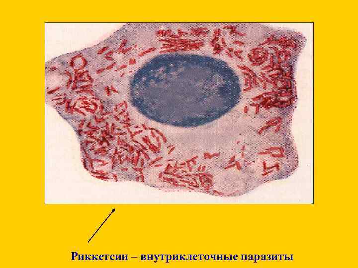 Риккетсии – внутриклеточные паразиты 