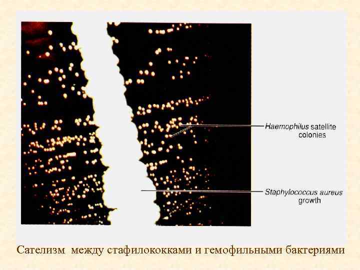 Сателизм между стафилококками и гемофильными бактериями 