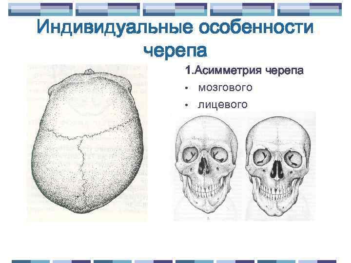 Индивидуальные особенности черепа 1. Асимметрия черепа • мозгового • лицевого 