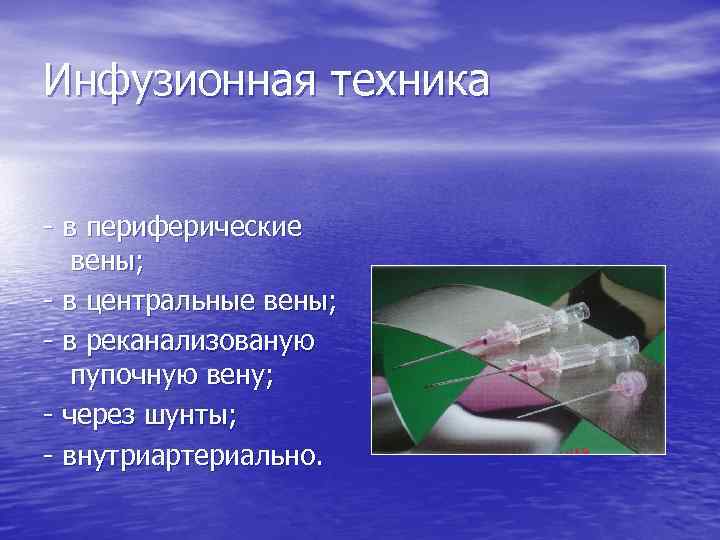 Инфузионная техника - в периферические вены; - в центральные вены; - в реканализованую пупочную