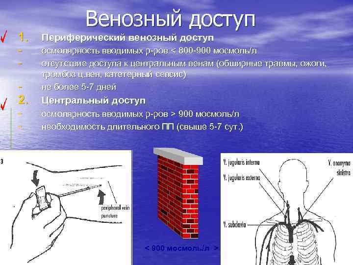 Венозный доступ 1. Периферический венозный доступ - осмолярность вводимых р-ров < 800 -900 мосмоль/л