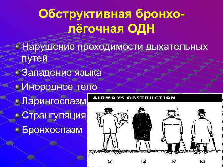  Обструктивная бронхо- лёгочная ОДН Нарушение проходимости дыхательных путей Западение языка Инородное тело Ларингоспазм