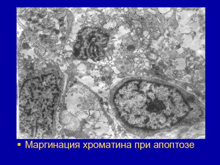 § Маргинация хроматина при апоптозе 