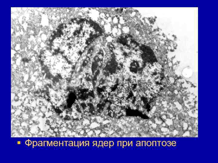 § Фрагментация ядер при апоптозе 