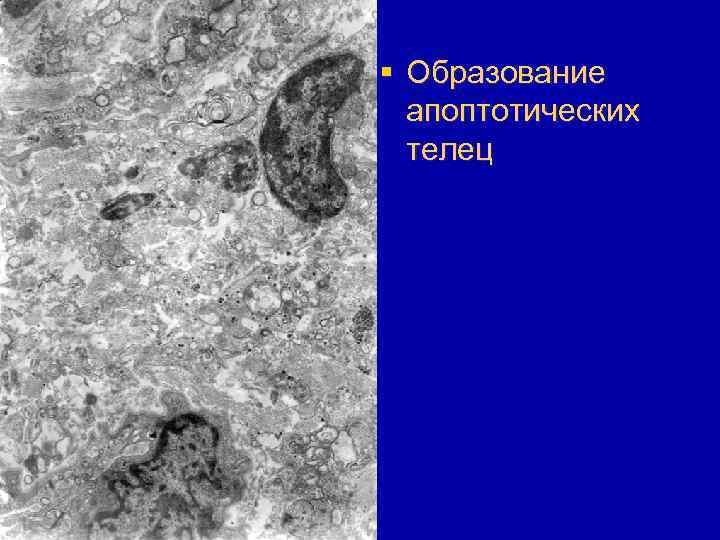 § Образование апоптотических телец 