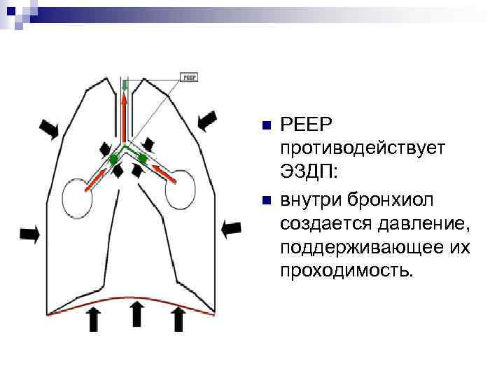 n n PEEP противодействует ЭЗДП: внутри бронхиол создается давление, поддерживающее их проходимость. 