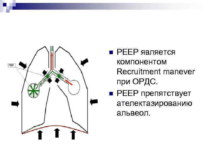 n n PEEP является компонентом Recruitment manever при ОРДС. PEEP препятствует ателектазированию альвеол. 
