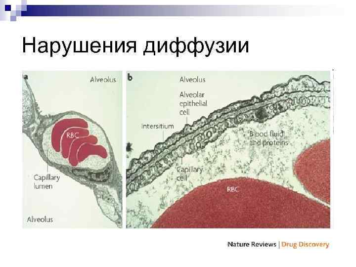 Нарушения диффузии 