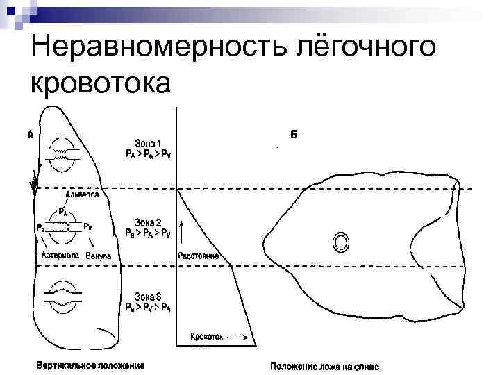 Неравномерность лёгочного кровотока 