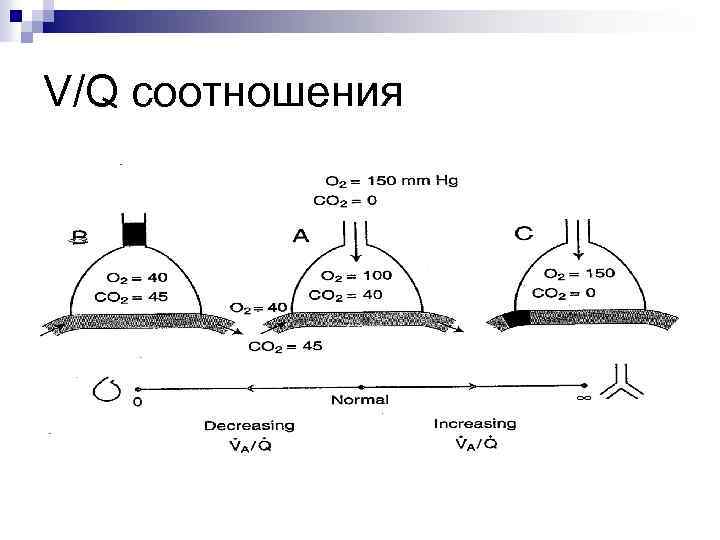 V/Q соотношения 