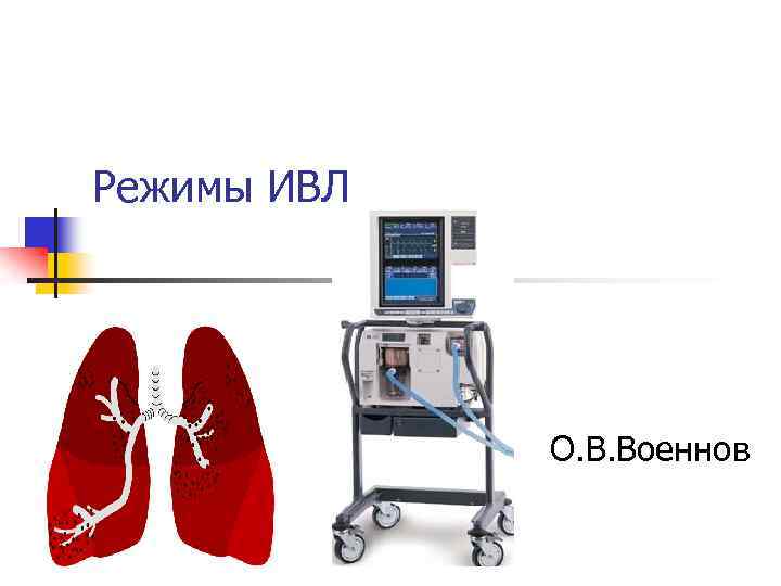 Схема работы ивл