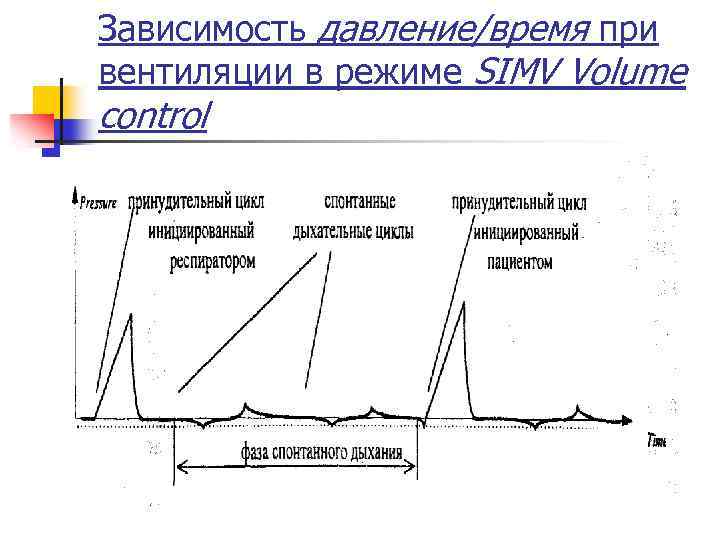 Зависимость давление/время при вентиляции в режиме SIMV Volume control 