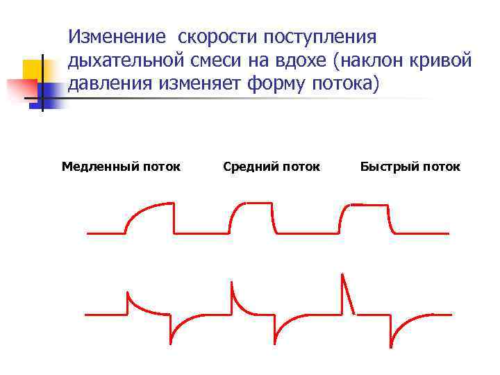 Изменение скорости поступления дыхательной смеси на вдохе (наклон кривой давления изменяет форму потока) Медленный