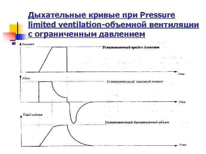 Дыхательные кривые при Pressure limited ventilation-объемной вентиляции с ограниченным давлением 