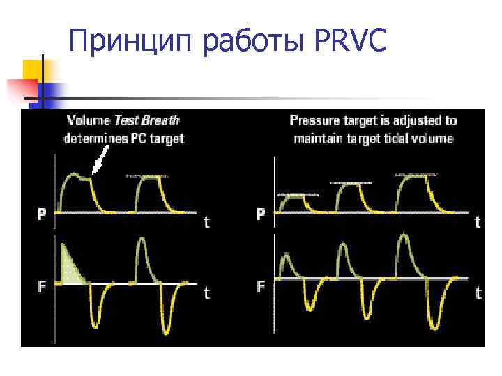 Принцип работы PRVC 