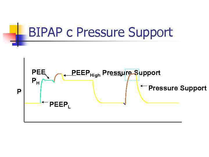 BIPAP с Pressure Support PEE PH PEEPHigh Pressure Support P PEEPL 
