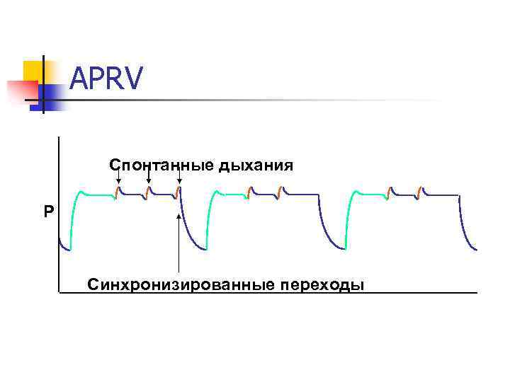 APRV Спонтанные дыхания P Синхронизированные переходы 