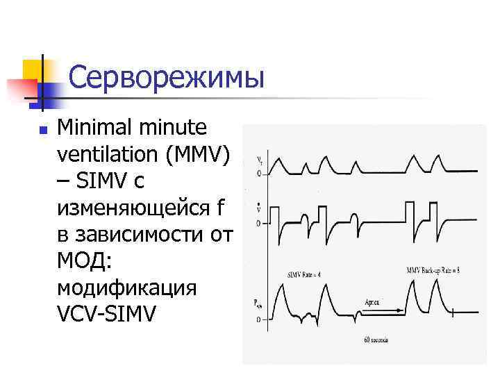 Серворежимы n Minimal minute ventilation (MMV) – SIMV с изменяющейся f в зависимости от