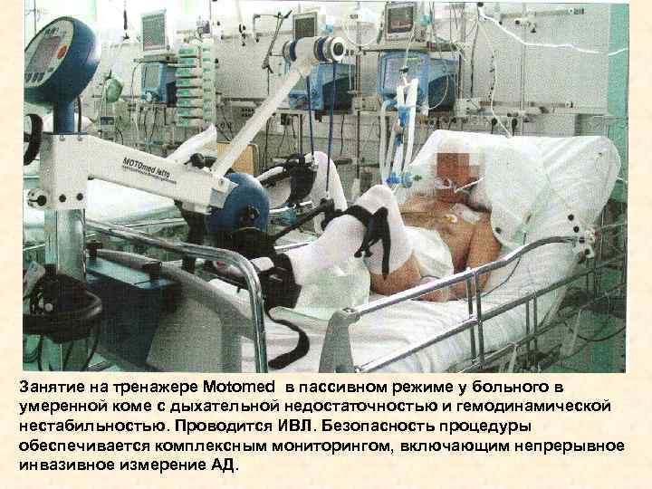 Занятие на тренажере Motomed в пассивном режиме у больного в умеренной коме с дыхательной