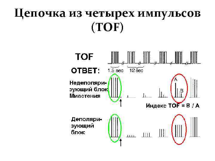 Цепочка из четырех импульсов (TOF) 