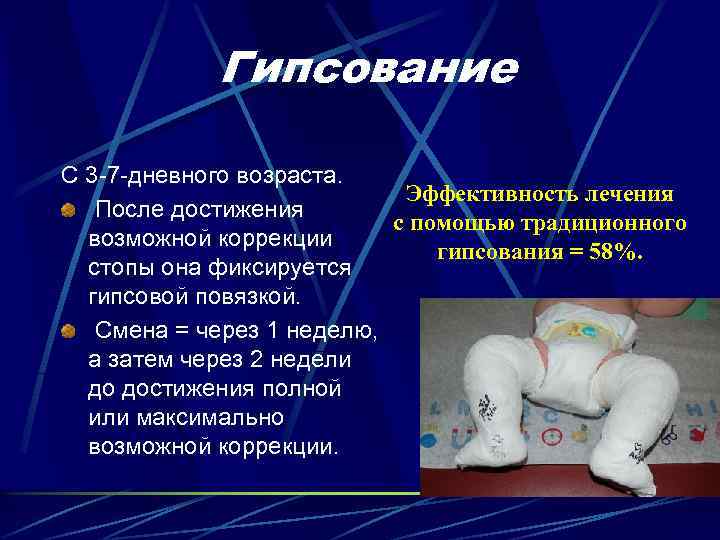 Гипсование С 3 -7 -дневного возраста. Эффективность лечения После достижения с помощью традиционного возможной