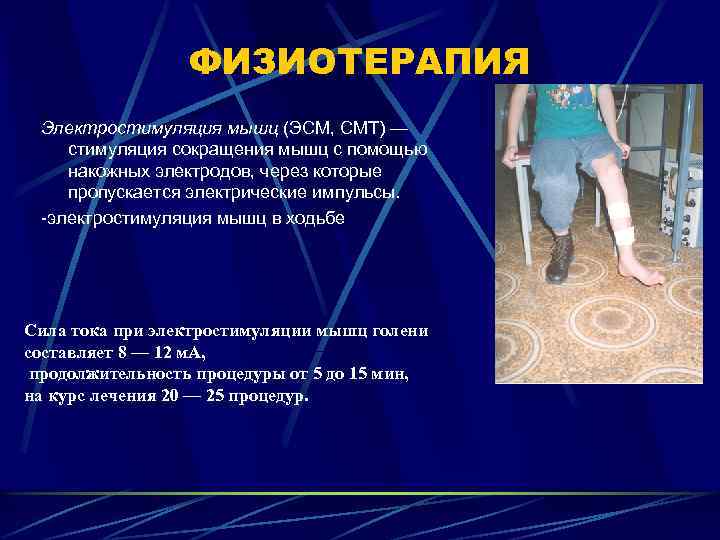 ФИЗИОТЕРАПИЯ Электростимуляция мышц (ЭСМ, СМТ) — стимуляция сокращения мышц с помощью накожных электродов, через