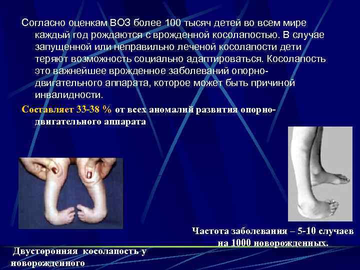 Согласно оценкам ВОЗ более 100 тысяч детей во всем мире каждый год рождаются с