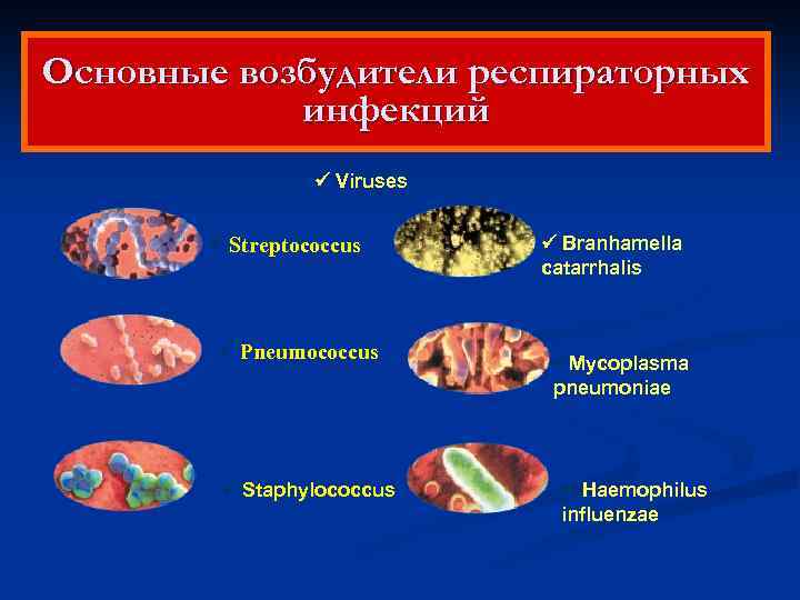 Основные возбудители респираторных инфекций Viruses Streptococcus Branhamella catarrhalis Pneumococcus Mycoplasma pneumoniae Staphylococcus Haemophilus influenzae