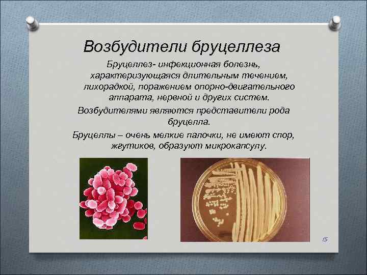 Возбудители бруцеллеза Бруцеллез- инфекционная болезнь, характеризующаяся длительным течением, лихорадкой, поражением опорно-двигательного аппарата, нервной и