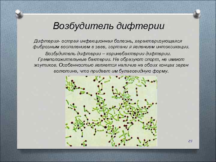 Возбудитель дифтерии Дифтерия- острая инфекционная болезнь, характеризующаяся фиброзным воспалением в зеве, гортани я явлением