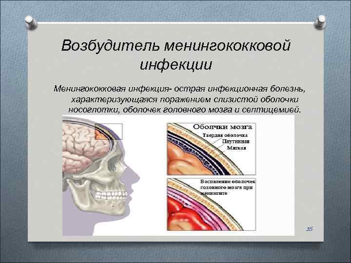 Менингококковая инфекция картинки