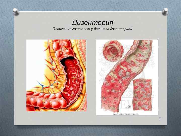 Возбудители кишечных инфекций фото