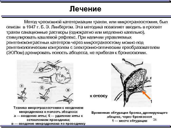 Лечение Метод чрескожной катетеризации трахеи, или микротрахеостомия, был описан в 1947 г. Б. Э.