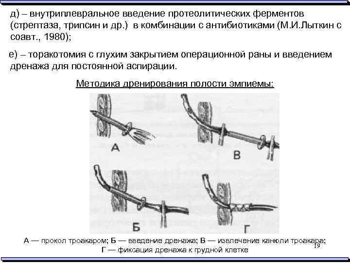 д) – внутриплевральное введение протеолитических ферментов (стрептаза, трипсин и др. ) в комбинации с