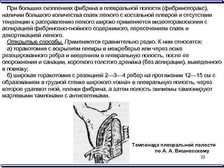 Гнойные заболевания легких презентация