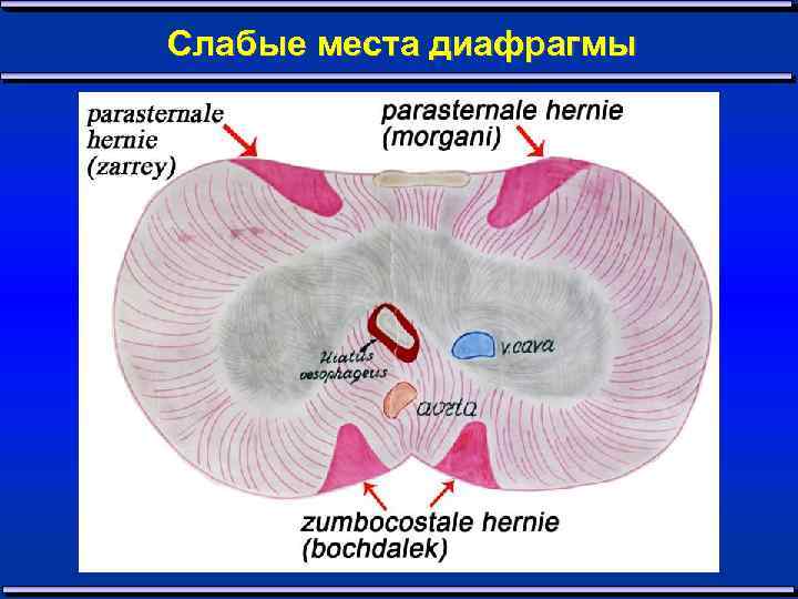 Слабые места диафрагмы 