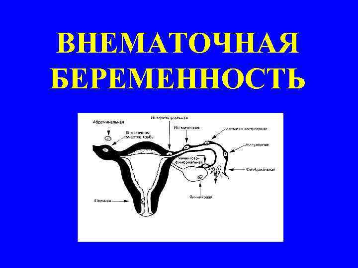 Отслойка плаценты карта вызова