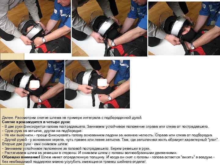 Далее. Рассмотрим снятие шлема на примере интеграла с подбородочной дугой. Снятие производится в четыре