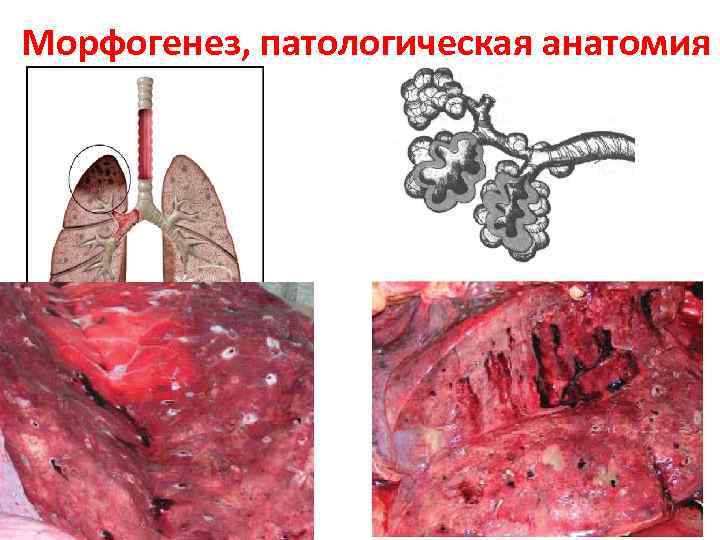  Морфогенез, патологическая анатомия 