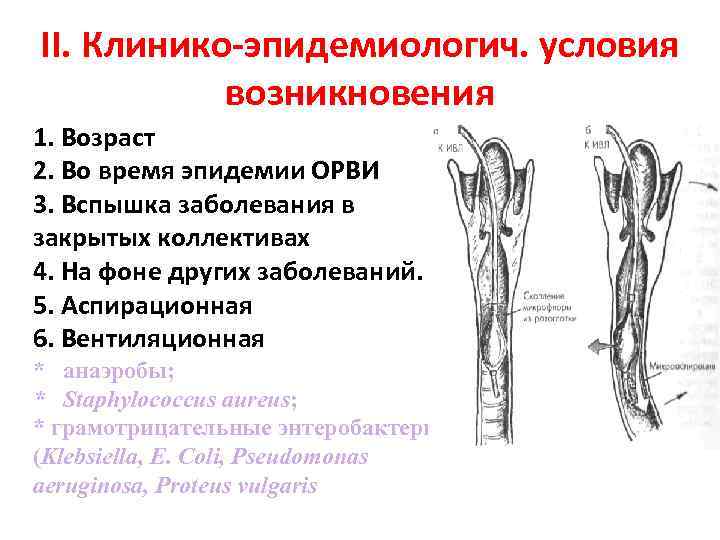 II. Клинико-эпидемиологич. условия возникновения 1. Возраст 2. Во время эпидемии ОРВИ 3. Вспышка заболевания