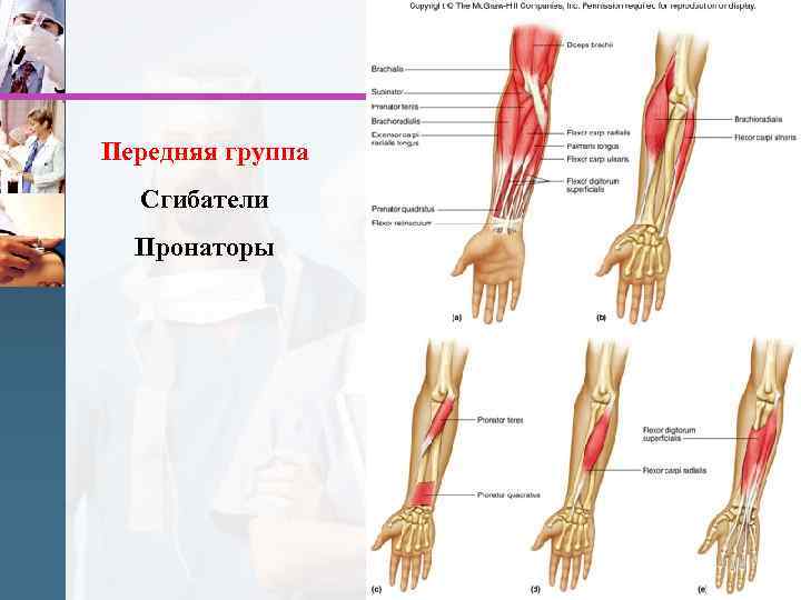 Передняя группа Сгибатели Пронаторы 