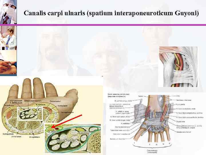 Canalis carpi ulnaris (spatium interaponeuroticum Guyoni) 
